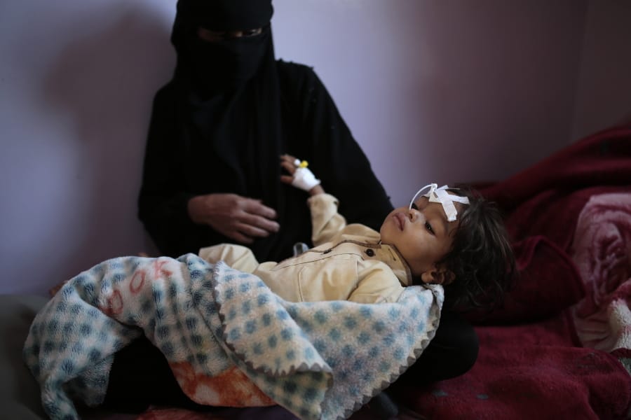 A woman holds her a malnourished boy at a feeding center at Al-Sabeen hospital in Sanaa, Yemen, Tuesday. Nov. 3, 2020. Two-thirds of Yemen&#039;s population of about 28 million people are hungry, and nearly 1.5 million families currently rely entirely on food aid to survive, with another million people are set to fall into crisis levels of hunger before the year end, according to aid agencies working in Yemen.