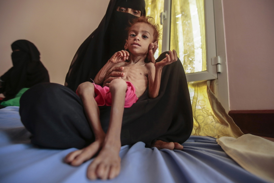 FILE - In this Oct. 1, 2018, file photo, a woman holds a malnourished boy at the Aslam Health Center, in Hajjah, Yemen. A leading aid organization on Monday warned that U.S. Secretary of State Mike Pompeo&#039;s move to designate Yemen&#039;s Iran-backed Houthi rebels as a &quot;foreign terrorist organization&quot; would deal another &quot;devastating blow&quot; to the impoverished and war-torn nation.