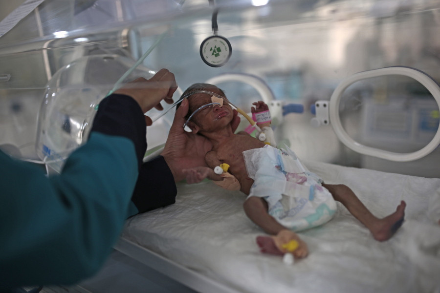 FILE - In this June 27, 2020 file photo, a medic checks a malnourished newborn baby inside an incubator at Al-Sabeen hospital in Sanaa, Yemen.  On Friday, Feb. 12, 2021, the United Nations is sounding the alarm over projections that more than 2 million Yemeni children are facing starvation this year.