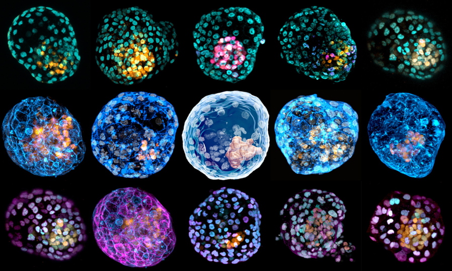 This undated combination of microscope images provided by Monash University in March shows different &quot;iBlastoids&quot; (embryolike structures) stained to highlight different cell types.