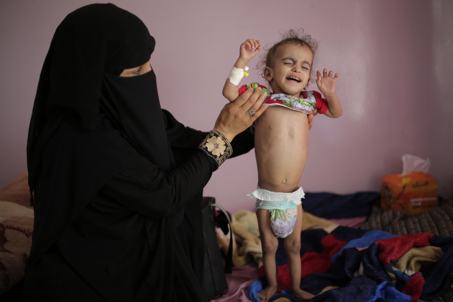 FILE - In this Nov. 23, 2019 file photo, a woman holds her malnourished boy at a feeding center at the Al-Sabeen Hospital in Sanaa, Yemen. After a visit to Yemen the World Food Program&#039;s executive director, David Beasley, warned that his underfunded organization may be forced seek hundreds of millions of dollars in private donations in a desperate bid to stave off widespread famine in the coming months.