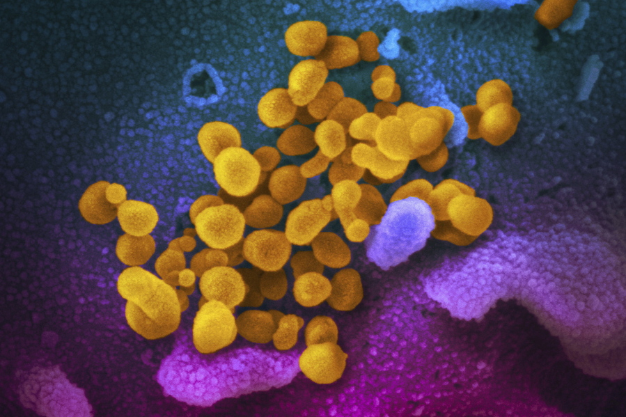 FILE - This undated electron microscope image made available by the U.S. National Institutes of Health in February 2020 shows the Novel Coronavirus SARS-CoV-2, yellow, emerging from the surface of cells, blue/pink, cultured in the lab. The sample was isolated from a patient in the U.S. According to an analysis by the federal Centers for Disease Control and Prevention published Tuesday, April 6, 2021 in JAMA Pediatrics, most children with a serious inflammatory illness linked to the coronavirus had initial COVID-19 infections with no symptoms or only mild ones, new U.S. research shows.