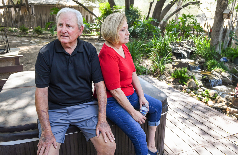 Dick and Diane Nichols in the backyard of their home in Prather, Calif., on August 25, 2021, a year after their former residence was destroyed in the Creek fire. It was the second time in five years their home was destroyed by fire.