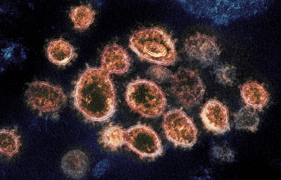 FILE - This 2020 electron microscope image provided by the National Institute of Allergy and Infectious Diseases - Rocky Mountain Laboratories shows SARS-CoV-2 virus particles which cause COVID-19, isolated from a patient in the U.S., emerging from the surface of cells cultured in a lab. According to a study released in The Lancet Global Health on Wednesday, Oct. 27, 2021, Fluvoxamine, a cheap antidepressant, reduced the need for hospitalization among high-risk adults with COVID-19.