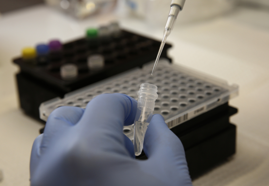 A lab specialist manually pipettes a mix for coronavirus testing.