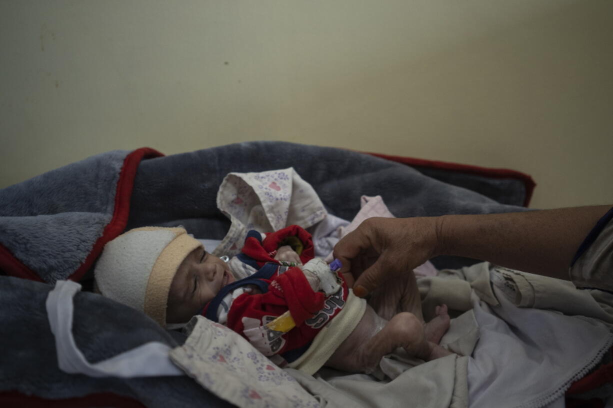 Four-month-old Mohammed who is malnourished lays on a hospital bed in the Indira Gandhi hospital in Kabul, Afghanistan, Monday, Nov. 8, 2021. The number of people living in Afghanistan in near-famine conditions has risen to 8.7 million according to the World Food Program.