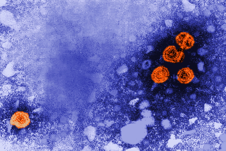 This 1981 electron microscope image made available by the U.S. Centers for Disease Control and Prevention shows hepatitis B virus particles, indicated in orange. The round virions, which measure 42nm in diameter, are known as Dane particles. On Wednesday, Nov. 3, 2021, a government advisory committee recommended that all U.S. adults younger than 60 be vaccinated against hepatitis B, because progress against the liver-damaging disease has stalled. (Dr.