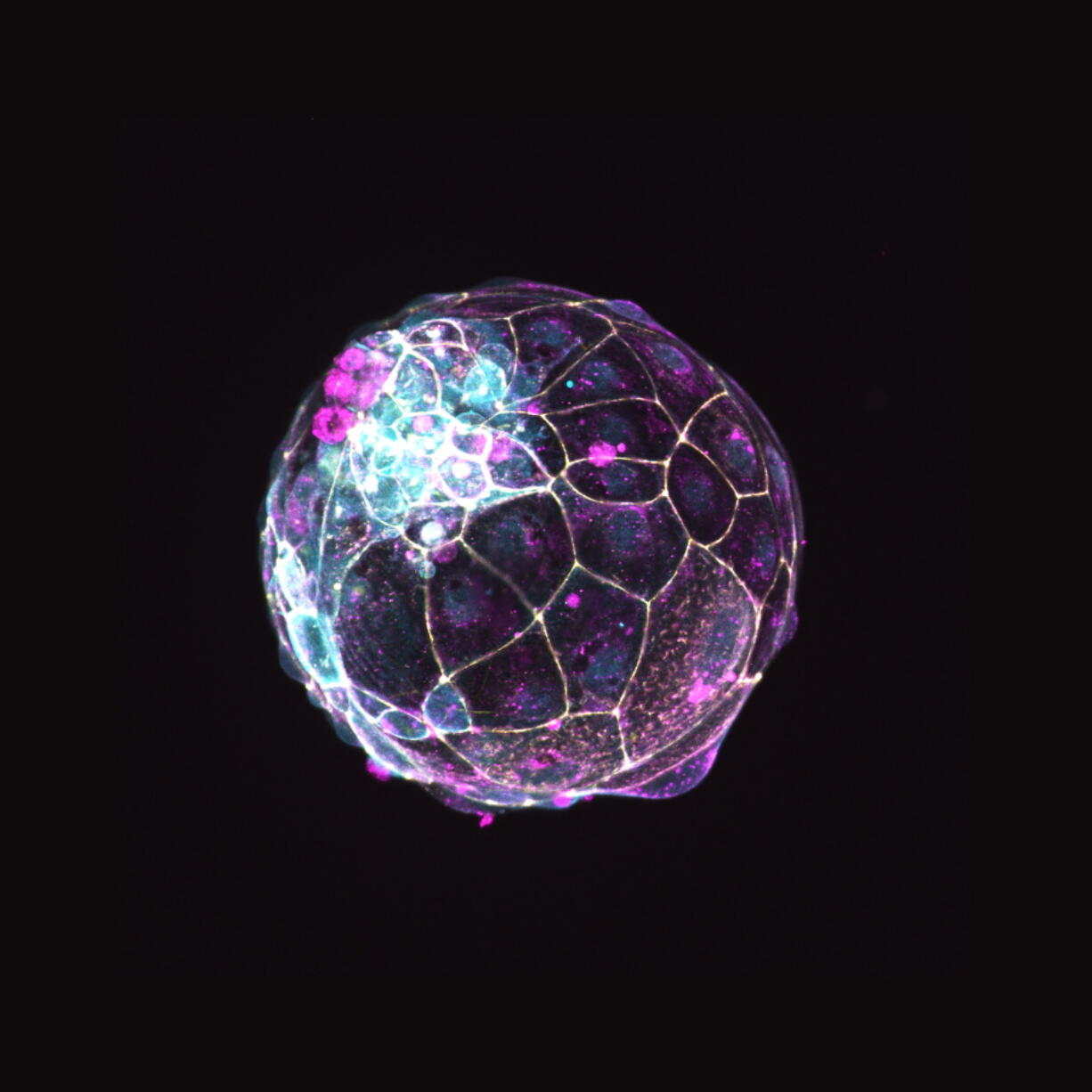 This image, provided by the Institute of Molecular Biology of the Austrian Academy of Sciences, shows a human "blastoid" created in a lab. A new study in Nature on Thursday, Dec. 2, 2021, shows how scientists created this structure that mimics a blastocyst, a ball of cells that form within a week of fertilization, and can be used in research.