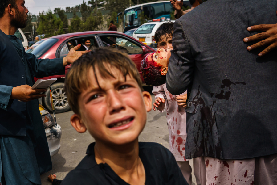 A man carries a bloodied child, as a woman lays wounded on the street after Taliban fighters use gunfire, whips, sticks and sharp objects to maintain crowd control over thousands of Afghans who continue to wait outside the Kabul Airport for a way out, on airport road in Kabul, Afghanistan, Tuesday, Aug. 17, 2021.