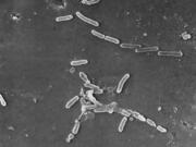 This scanning electron microscope image made available by the Centers for Disease Control and Prevention shows rod-shaped Pseudomonas aeruginosa bacteria. According to a report published Thursday, Jan. 20, 2022, in the medical journal Lancet, antibiotic-resistant germs caused more than 1.2 million deaths globally in one year, according to new research that suggests that so-called "superbugs" have joined the ranks of the world's leading infectious disease killers.
