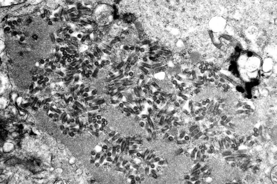 This undated electron microscope image made available by the Centers for Disease Control and Prevention shows rabies virions, dark and bullet-shaped, within an infected tissue sample. (F. A.