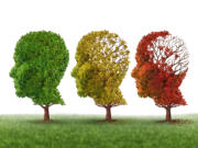 In numerous cases, mild cognitive impairment is found to be caused by something completely aside from Alzheimer's, such as obstructive sleep apnea or memory-hurting medications, depression or other disorders like Parkinson's disease. Vascular problems such as undetected strokes can be a cause, as can a vitamin B-12 deficiency or mood disorders.