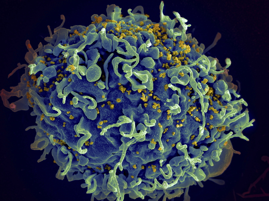 FILE - This colorized electron microscope image made available by the U.S. National Institutes of Health shows a human T cell, indicated in blue, under attack by HIV, in yellow, the virus that causes AIDS. In a study released in the journal Nature on Thursday, April 28, 2022, climate change will result in thousands of new viruses spread among animal species by 2070, which is likely to increase the risk of emerging infectious diseases jumping from animals to humans.