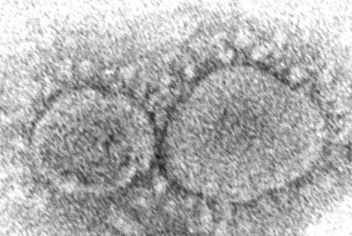 FILE - This 2020 electron microscope image made available by the Centers for Disease Control and Prevention shows SARS-CoV-2 virus particles which cause COVID-19. The coronavirus mutant that just became dominant in the United States as of May 2022 is a member of the omicron family. But scientists say it spreads faster than its omicron predecessors, is adept at escaping immunity and might possibly cause more serious disease. (Hannah A.