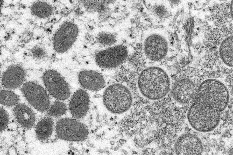 FILE - This 2003 electron microscope image made available by the Centers for Disease Control and Prevention shows mature, oval-shaped monkeypox virions, left, and spherical immature virions, right, obtained from a sample of human skin associated with the 2003 prairie dog outbreak. The Biden administration has started shipping testing kits for monkeypox to commercial laboratories, in a bid to speed diagnostic tests for suspected infections for the virus that has already infected at least 142 people in the U.S.(Cynthia S.