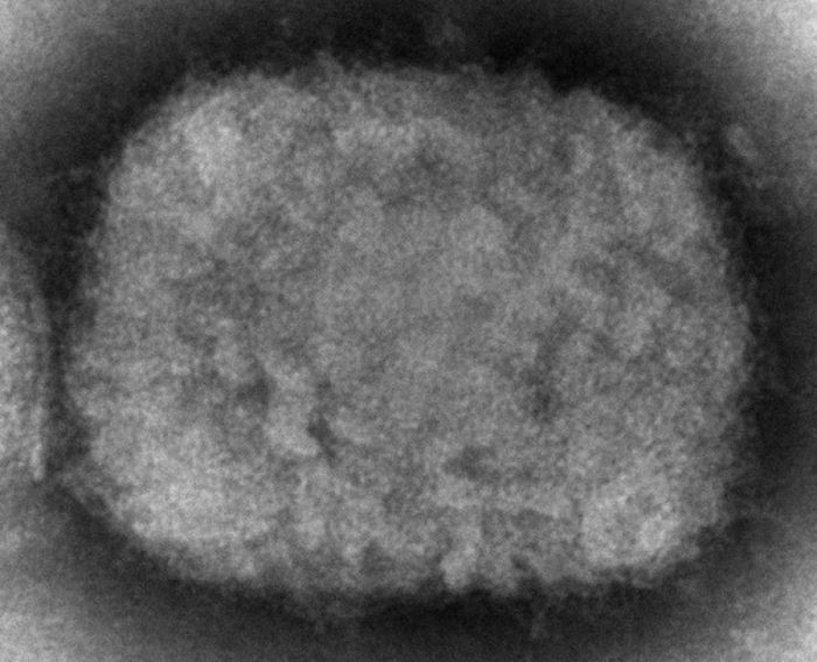 FILE - This 2003 electron microscope image made available by the Centers for Disease Control and Prevention shows a monkeypox virion, obtained from a sample associated with the 2003 prairie dog outbreak. The U.S. government is building up its supply of monkeypox vaccine to contend with escalating cases identified in a surprising international outbreak, health officials said Friday, June 10, 2022. (Cynthia S.