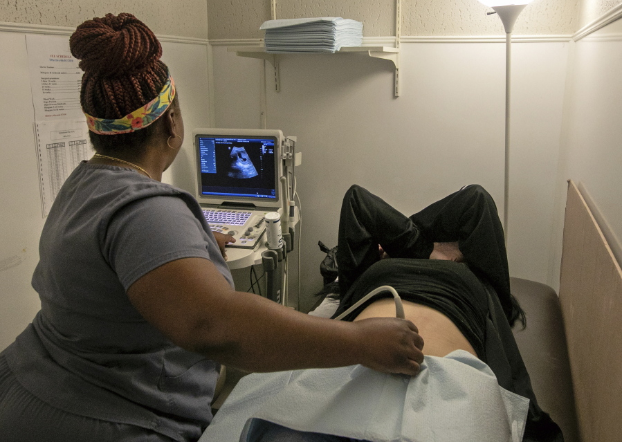 FILE - An operating room technician performs an ultrasound on a patient at Hope Medical Group for Women in Shreveport, La., on July 6, 2022. With access to abortion flickering in Louisiana, the legal battle over the statewide ban continues with a court hearing scheduled to begin Monday morning, July 18.