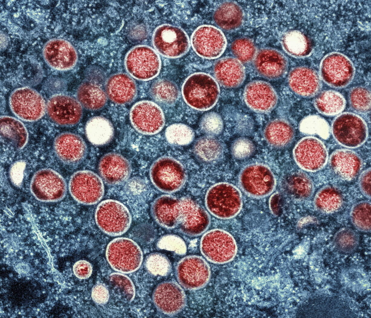 FILE - This image provided by the National Institute of Allergy and Infectious Diseases (NIAID) shows a colorized transmission electron micrograph of monkeypox particles (red) found within an infected cell (blue), cultured in the laboratory that was captured and color-enhanced at the NIAID Integrated Research Facility (IRF) in Fort Detrick, Md. On Friday, Aug. 12, 2022, The Associated Press reported on stories circulating online incorrectly claiming that monkeypox hasn't been detected in Georgia drinking water. The July 26 Atlanta-area news broadcast broadcast is being mischaracterized online to push the false claim that monkeypox has been found in residents' tap water.