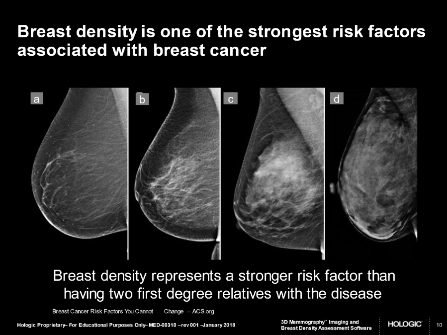 Doctor says women with dense breasts require closer ‘surveillance’ for cancer