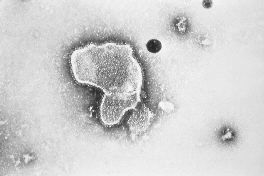 This 1981 photo provided by the Centers for Disease Control and Prevention (CDC) shows an electron micrograph of Respiratory Syncytial Virus, also known as RSV. Children's hospitals in parts of the country are seeing a distressing surge in RSV, a common respiratory illness that can cause severe breathing problems for babies. Cases fell dramatically two years ago as the pandemic shut down schools, day cares and businesses. Then, with restrictions easing, the summer of 2021 brought an alarming increase in what is normally a fall and winter virus.