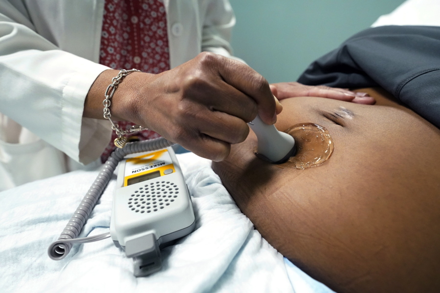 FILE - A doctor uses a hand-held Doppler probe on a pregnant woman to measure the heartbeat of the fetus on Dec. 17, 2021, in Jackson, Miss. COVID-19 drove a dramatic increase in the number of women who died from pregnancy or childbirth complications in the U.S. last year, a crisis that has disproportionately claimed Black and Hispanic women as victims, according to a report released Wednesday, Oct. 19, 2022. (AP Photo/Rogelio V.