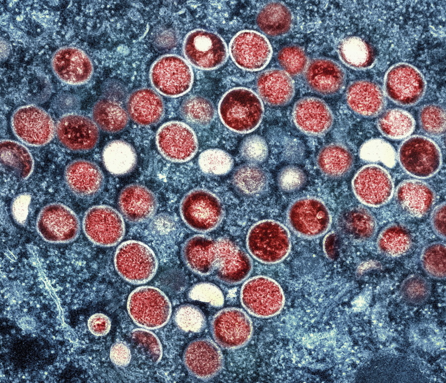 FILE - This image provided by the National Institute of Allergy and Infectious Diseases (NIAID) shows a colorized transmission electron micrograph of monkeypox particles (red) found within an infected cell (blue), cultured in the laboratory that was captured and color-enhanced at the NIAID Integrated Research Facility (IRF) in Fort Detrick, Md. The World Health Organization has renamed monkeypox as mpox, citing concerns the original name of the decades-old animal disease could be construed as discriminatory and racist.