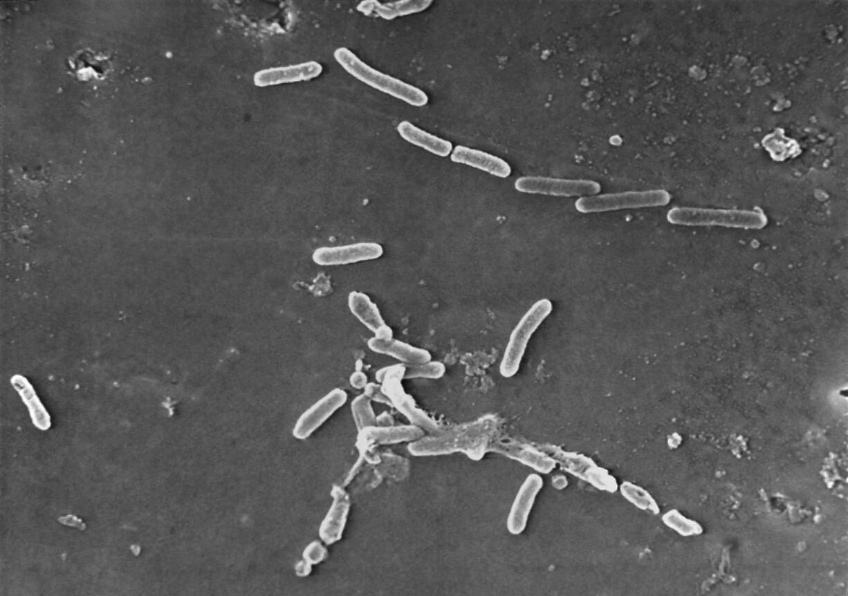 FILE - This scanning electron microscope image made available by the Centers for Disease Control and Prevention shows rod-shaped Pseudomonas aeruginosa bacteria. U.S. health officials are advising people to stop using the over-the-counter eye drops, EzriCare Artificial Tears, that have been linked to an outbreak of drug-resistant infections of Pseudomonas aeruginosa. The Centers for Disease Control and Prevention on Wednesday night, Feb. 1, 2023, sent a health alert to physicians, saying the outbreak includes at least 55 people in 12 states. One died.
