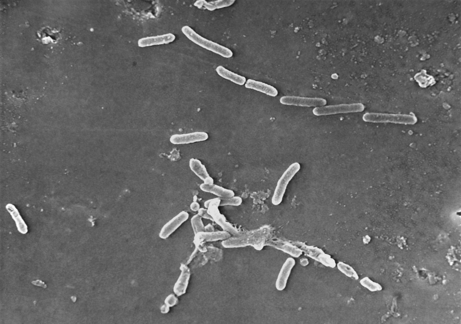 FILE - This scanning electron microscope image made available by the Centers for Disease Control and Prevention shows rod-shaped Pseudomonas aeruginosa bacteria. Experts are marveling at how U.S. disease detectives figured out how eyedrops were linked to dozens of infections.