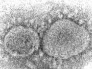 FILE - This 2020 electron microscope image made available by the Centers for Disease Control and Prevention shows SARS-CoV-2 virus particles, which cause COVID-19. A crucial question has eluded governments and health agencies since the COVID-19 pandemic began: Did the virus originate in animals or leak from a Chinese lab? Now, the U.S. Department of Energy has assessed with "low confidence" that it began with a lab leak although others in the U.S. intelligence community disagree. (Hannah A.