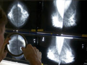 FILE - A radiologist uses a magnifying glass to check mammograms for breast cancer in Los Angeles, May 6, 2010. U.S. women getting mammograms will soon receive information about their breast density, which can sometimes make cancer harder to spot, under government rules finalized Thursday, March 9, 2023.