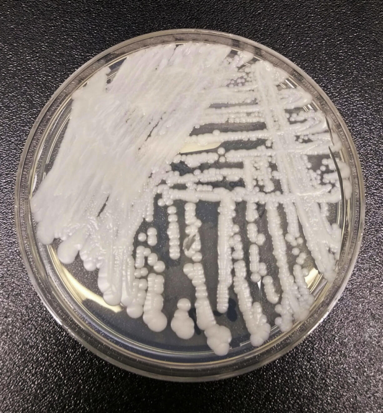 FILE - This undated photo made available by the Centers for Disease Control and Prevention shows a strain of Candida auris cultured in a petri dish at a CDC laboratory. In a CDC paper published by the Annals of Internal Medicine on Monday, March 20, 2023, U.S. cases of the dangerous fungus tripled over just three years, and more than half of states have now reported it.