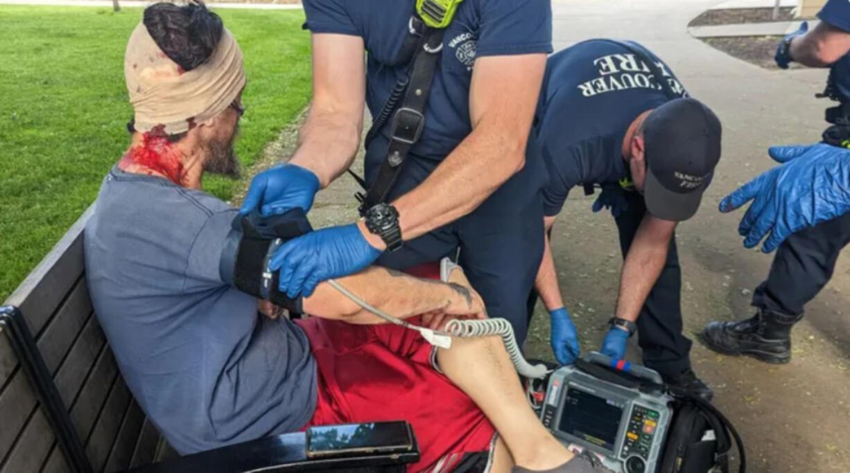 A man who was reportedly beaten by teenagers with skateboards Tuesday afternoon at Esther Short Park is treated by medical personnel.