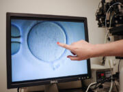 An embryologist shows an ovocyte after it was inseminated June 12, 2019, at the Virginia Center for Reproductive Medicine, in Reston, Va.