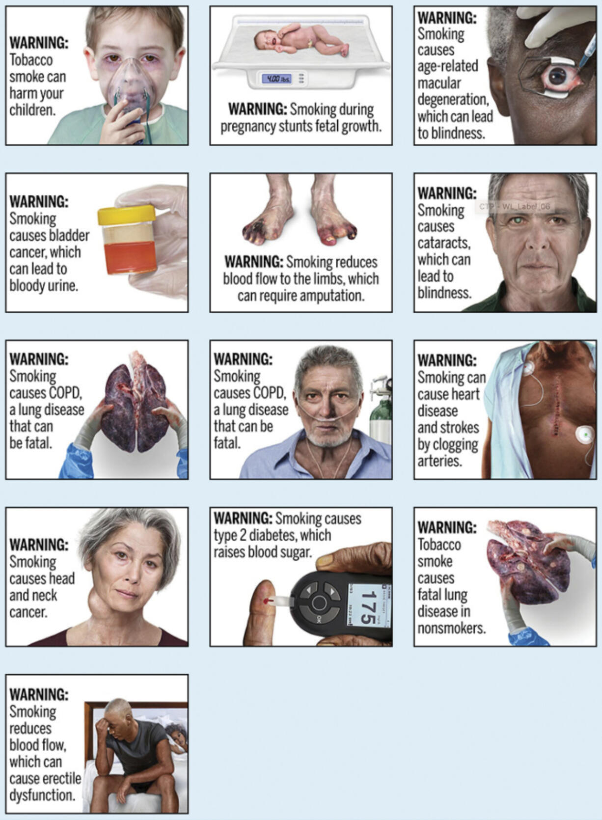FILE - This image provided by the U.S. Food and Drug Administration, Thursday, Aug. 15, 2019, shows proposed cigarette warning labels. A federal rule requiring that cigarette packs and advertising include graphic images  demonstrating the effects of smoking, including pictures of smoke-damaged lungs and feet blackened by diminished blood flow, does not violate the First Amendment, a federal appeals court ruled Thursday, March 21, 2024.