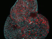 This microscope image provided by researchers in March 2024 shows a lung organoid created from cells collected from amniotic fluid. In a study published Monday, March 4, 2024, in the journal Nature Medicine, scientists in the United Kingdom described how they have made mini-organs from cells floating in amniotic fluid &ndash; an advance they believe could open up new areas of prenatal medicine.