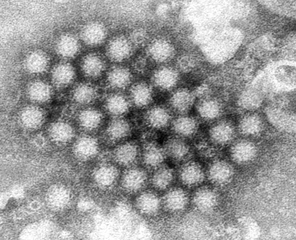 This electron microscope image provided by the Centers for Disease Control and Prevention shows a cluster of norovirus virions. (charles d.