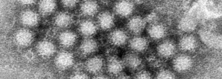 This electron microscope image provided by the Centers for Disease Control and Prevention shows a cluster of norovirus virions. (charles d.