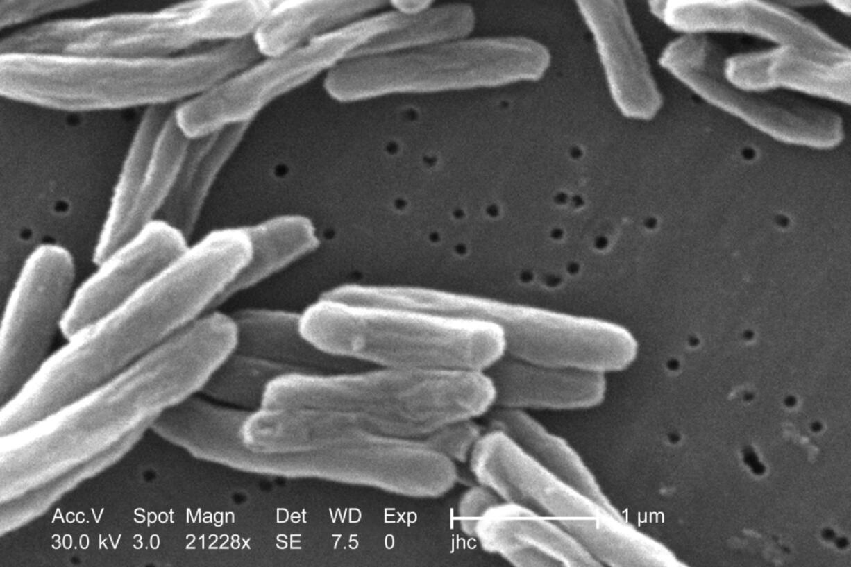 This 2006 electron microscope image provided by the Centers for Disease Control and Prevention shows Mycobacterium tuberculosis bacteria, which causes the disease tuberculosis. The number of U.S. tuberculosis cases in 2023 was the highest in a decade, according to a report released by the CDC on Thursday, March 28, 2024.