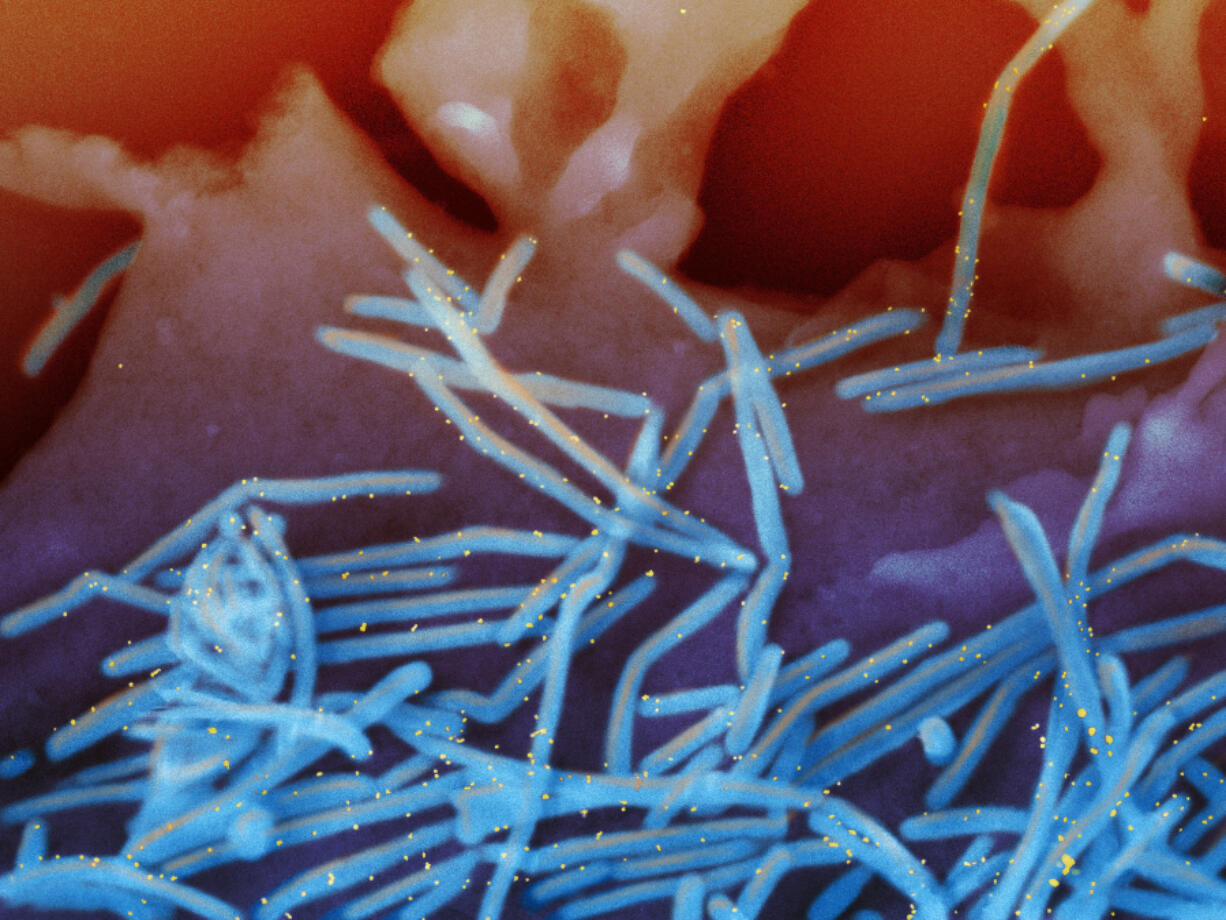 FILE - This electron microscope image provided by the National Institutes of Health shows human respiratory syncytial virus (RSV) virions, colorized blue, and anti-RSV F protein/gold antibodies, colorized yellow, shedding from the surface of human lung cells. In a report released Thursday, May 30, 2024, the Centers for Disease Control and Prevention said they are continuing to investigate a link between two new RSV vaccines and cases of a rare nervous system disorder in older U.S. adults.